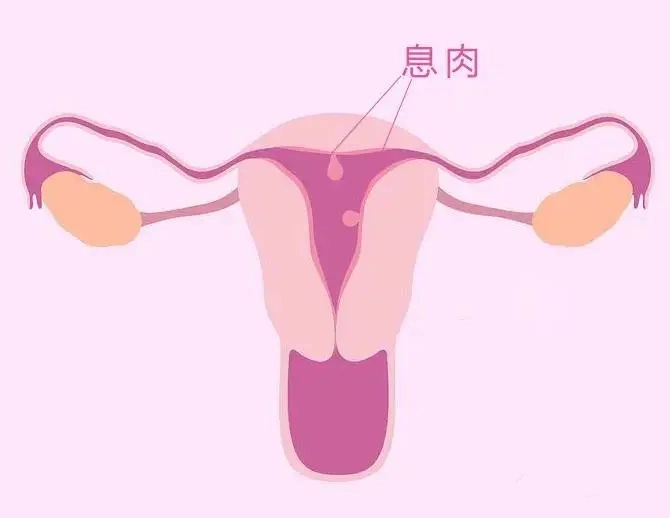 千萬(wàn)別忽視求子路上的這個(gè)“攔路虎”！