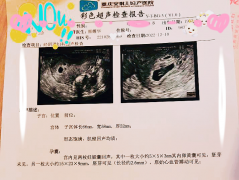 7年求子苦終迎一朝甜，她來安琪兒試管助孕1次就懷上了